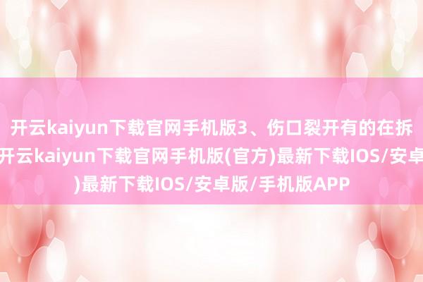 开云kaiyun下载官网手机版3、伤口裂开有的在拆线后伤口裂开-开云kaiyun下载官网手机版(官方)最新下载IOS/安卓版/手机版APP